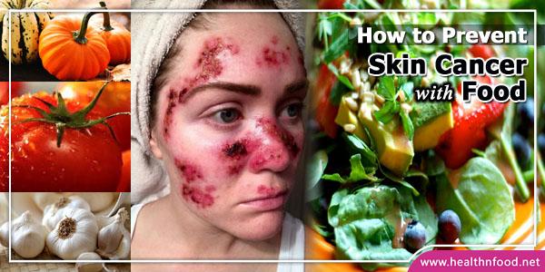 How to Prevent Skin Cancer with Food