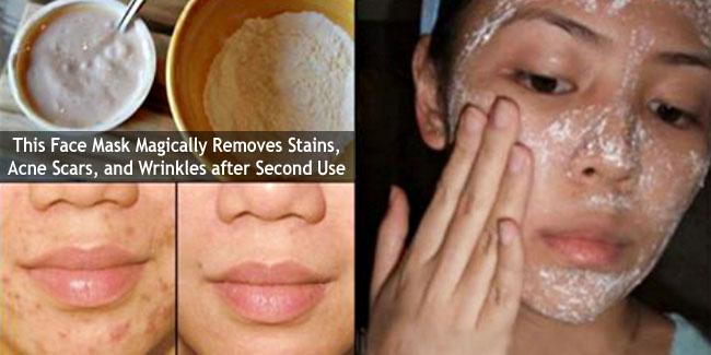 Homemade Face Mask for Acne Scars and Wrinkles