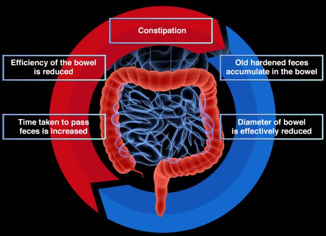 Medical Conditions that Cause Constipation