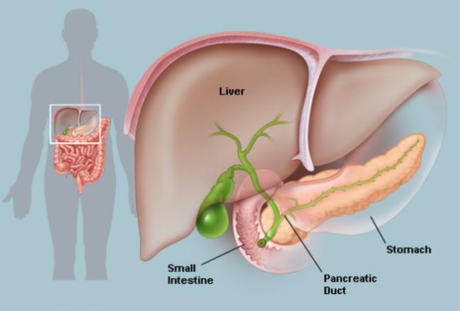 How Severe is Pancreatic Cancer