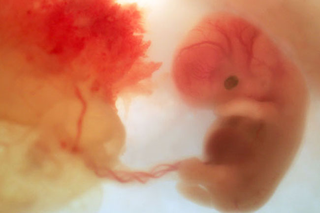 Stages of Fetal Growth and Development